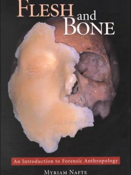 Flesh and Bone first edition cover, Carolina Academic Press 2000